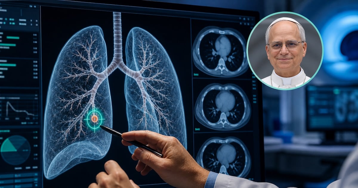 Nódulo pulmonar: por qué se opera un punto de tres milímetros y qué dice la ciencia detrás de la decisión