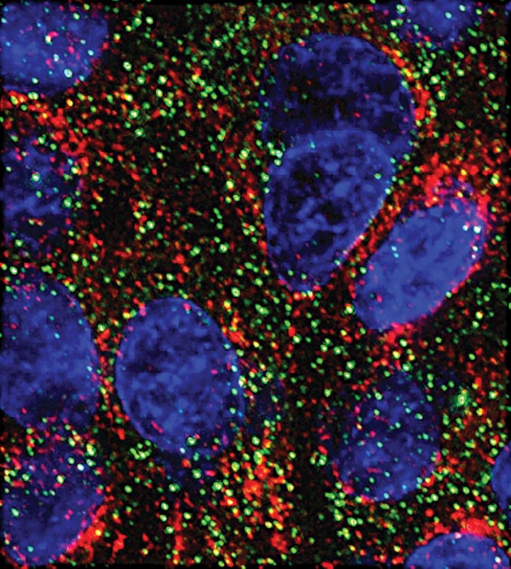 MicroARN reducen el crecimiento de células pancreáticas en un estudio de laboratorio
